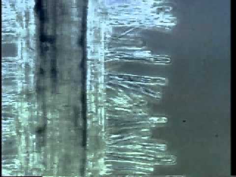 Root Hair Cell Under Microscope - Micropedia