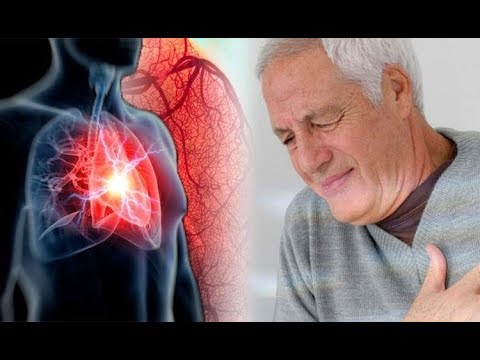 ئەگەر ئەم نیشانانەت لێدەرکەوت بزانە نەخۆشى دڵت هەیە
