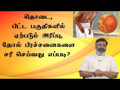 தொடை பிட்ட பகுதிகளில் ஏற்படும் அரிப்புகளை சரிசெய்வது எப்படி