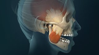 TMJ Pain: Headaches, Earaches and Spasms