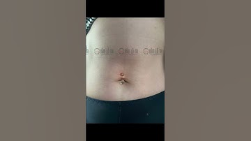 Xỏ khuyên rốn chuẩn y khoa