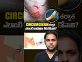 సున్తీ తర్వాత జాగ్రత్తలు | Precautions After KSR Stapler Circumcision | Treatment Range Hospitals