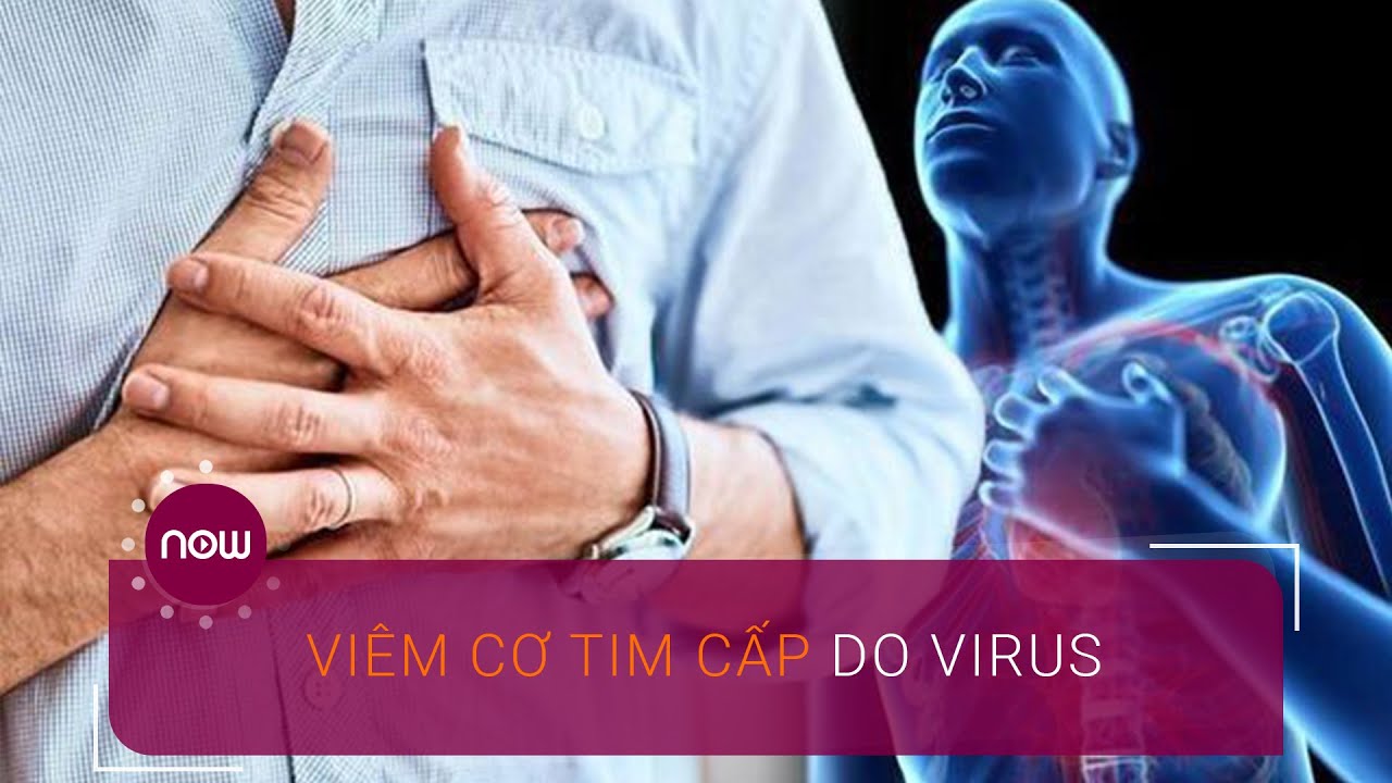 Hiểu đúng về viêm cơ tim cấp do virus | VTC Now - YouTube