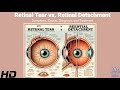 Retinal Tear Vs Retinal Detachment Know The Difference And Save Your Vision