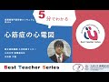 日本循環器学会　5分でわかる循環器Best Teacher Series　心筋症の心電図　 九州大学　循環器内科　矢加部大輔