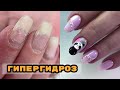 ГИПЕРГИДРОЗ 🥺 Как с этим работать? 💅 Маникюр с весенними гелями Si