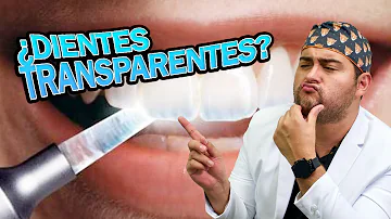 ¿Qué aspecto tienen los dientes cuando ya no tienen esmalte?