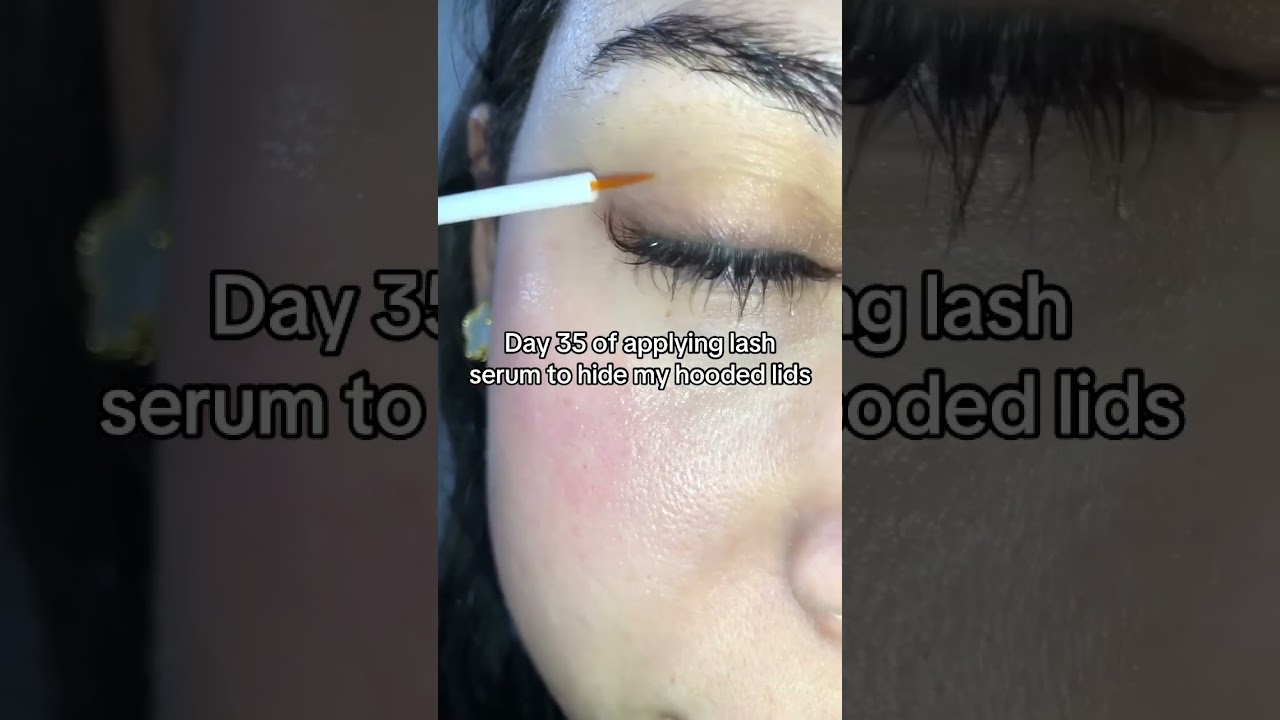 My lil hack that actually worked