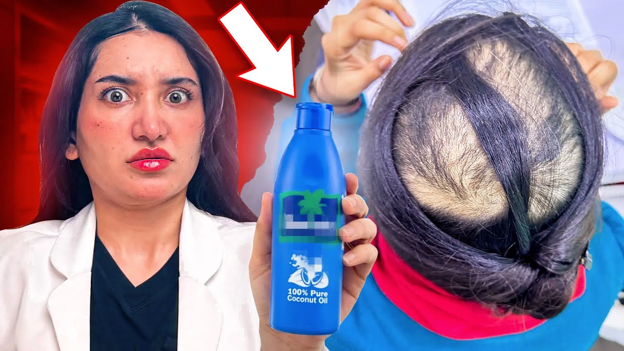 This One Mistake Caused Permanent Hair Loss !