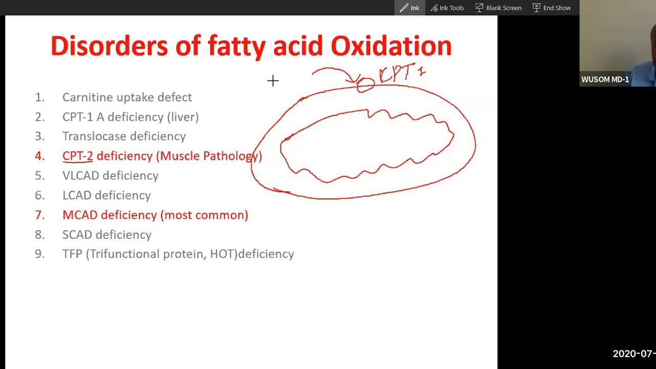 Oxidation of Fatty acid 2; MCAD def., CPT2 def., regulation of beta