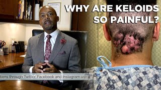 #AskDrJones Why Are Keloids Painful?