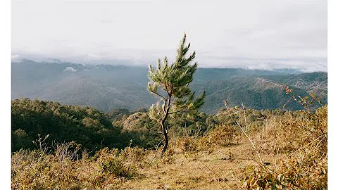 skeletal dysplasia's in children- radiological approach