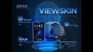 Beijing Adss Newest Skin Ysis Machine