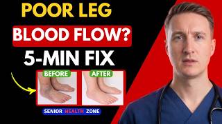 Famous Poor Leg Circulation 30 Second Test + 3 Fast Fix Wealth