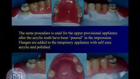 DENT 718: Repairing complete and partial dentures