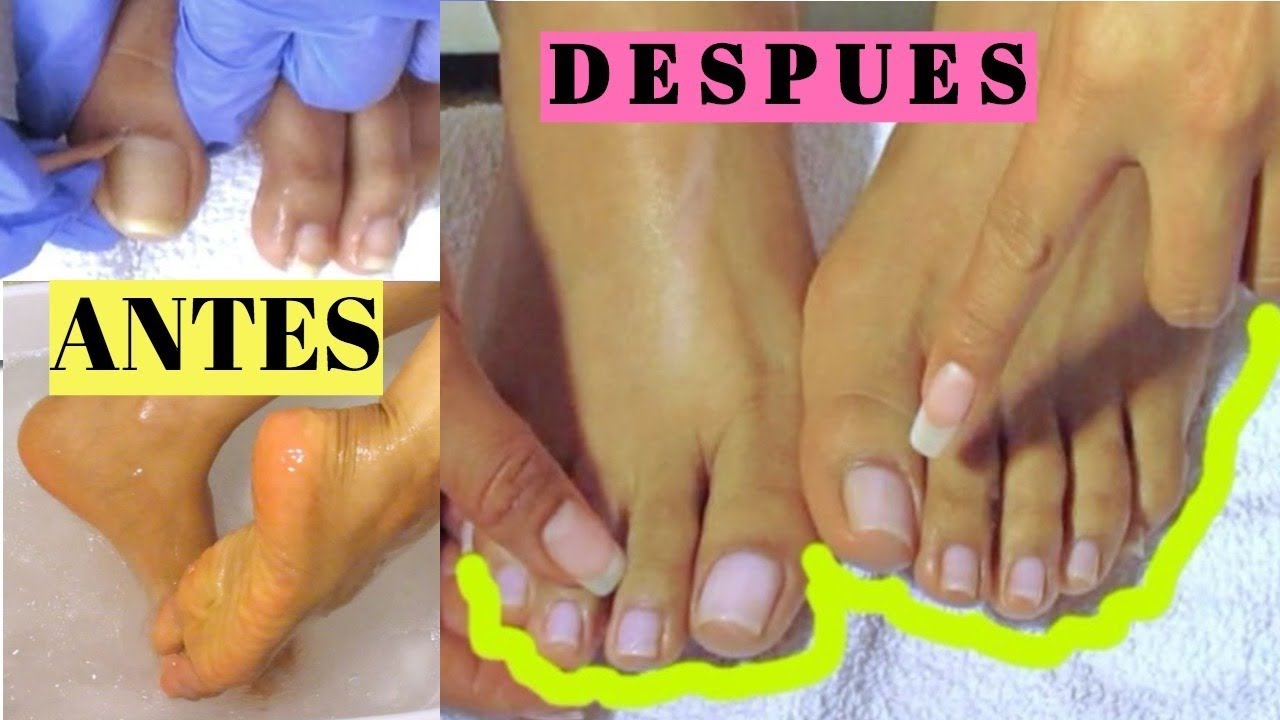Así me mis uñas los pies/My Pedicure rutine/Como limpiar las uñas? - YouTube