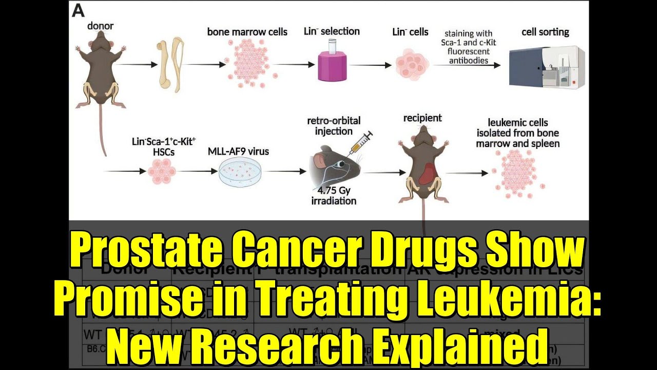 Prostate Cancer Drugs Show Promise in Treating Leukemia: New Research ...