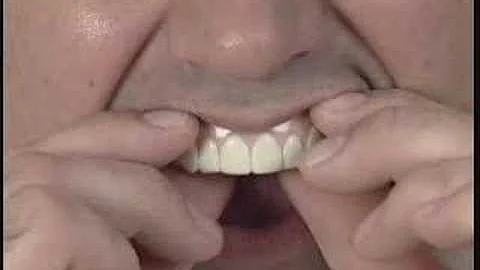 Imako Cosmetic Teeth Fitting Instructions