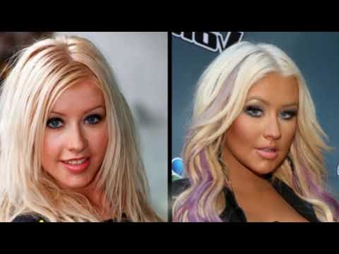 Video: Plastic Surgery Works Wonders: Photos Of Famous Actresses Before And After Plastic Surgery