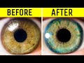 How To Improve Eyes Health | Natural Ways To Improve GLAUCOMA