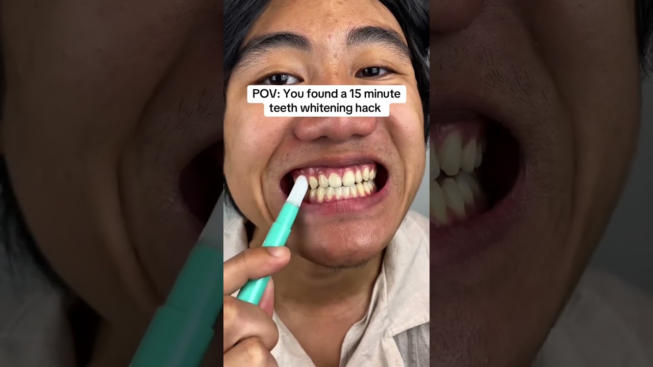 The Dr. Brite whitening pen actually does wonders to your teeth.