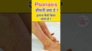 Psoriasis क्या है? इसके symptoms क्या होते है और psoriasis Treatment कैसे होता है ? #shortsfeed