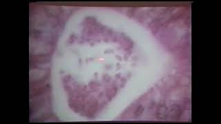 Identification of Protozoan Parasites in Tissue Section  - Dr  Gardiner 1993