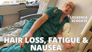 Leukemia: Faith in God through AML Cancer Transplant Hair Loss, Nausea, fatigue Vlog#18