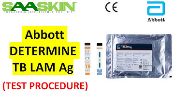 Abbott DETERMINE TB LAM Ag | Catalog No - #7D2741 | Medical IVD | Rapid Test | Test Procedure |