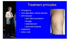 Septic arthritis treatment principles - Daniel Fritschy MD, EFORT Congress Nice 2009.wmv