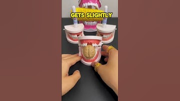 No Dentist? No Problem – Instant Tooth🦷Repair😁👌 #youtubeshorts #shortsfeed #shorts #ytshorts #beauty