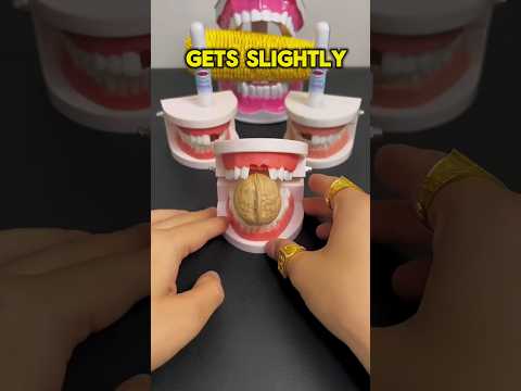 No Dentist? No