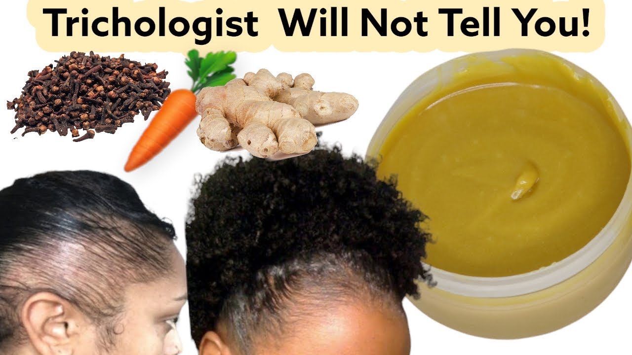 Alopecia Bald Hair Growth Treatments/Follicle Strength, Don’t Wash It Out, Massage 2/3 Times A Week