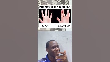 Normal or rare? #duet #funny #memes #comedy #lipsyncs #funnymemes #nutshellgroup #funnyimages