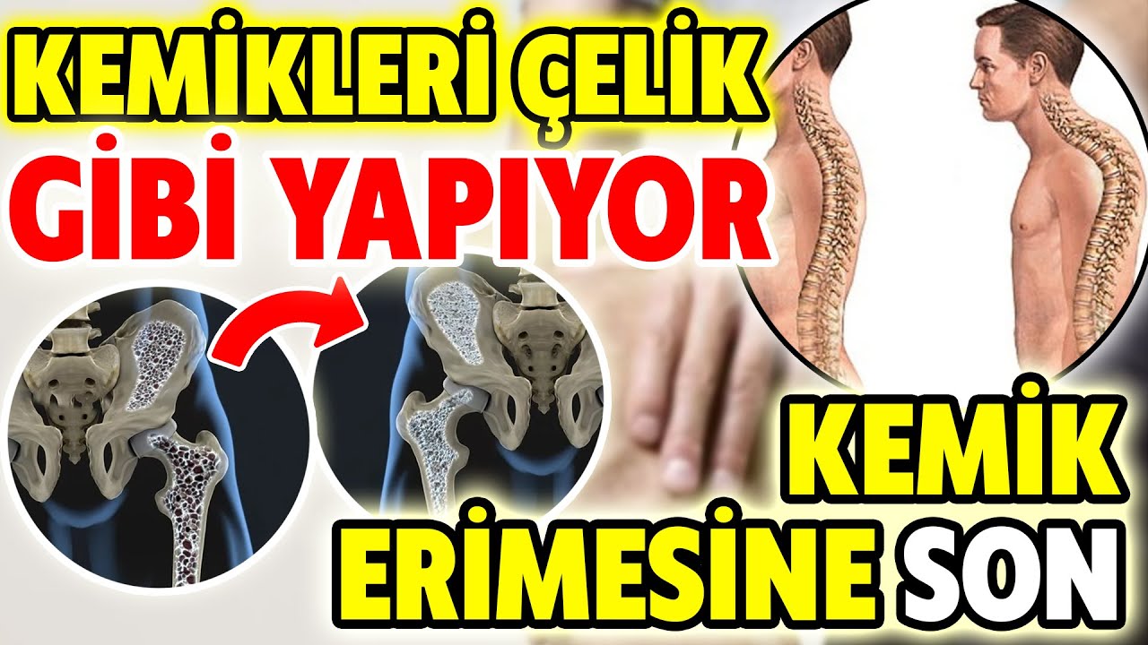 Kemik Erimesini Önleyen Mucize Kür GÜNDE 1 ADET YETERLİ