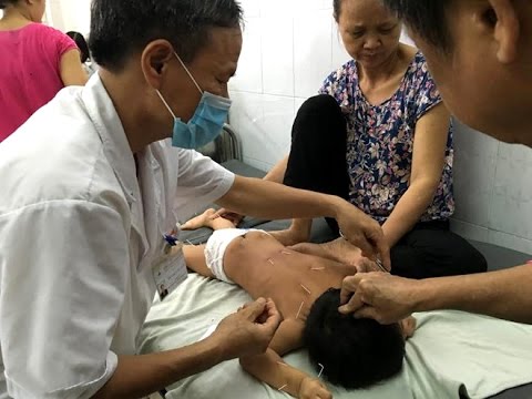 Video Tin tức trong ngày - Những chiếc kim giúp trẻ bại liệt... - youtube