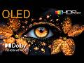 The Most Realistic Colors Ever – OLED 4K Ultra HD HDR Dolby Vision (4K/8K TV)