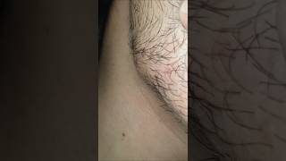 Asmr hair #massage therapy #ingrownhair #haircare #relax #hairgrowth #shorts #video #viral