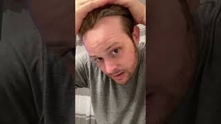 ?Transform Your Look in Under 5 Minutes hairloss hair beforeandafter hairstyle transformation