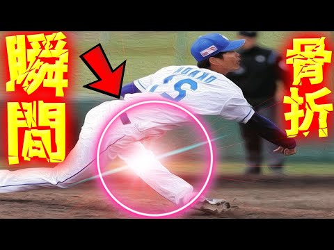 【悲報】中日 岡田俊哉 右大腿骨骨折の瞬間!批判殺到! プロ野球 負傷交代 中日ドラゴンズ 中継 動画 おかだしゅんや ハイライト