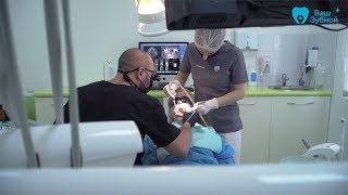 Имплантация зубов: технология, уход, преимущества