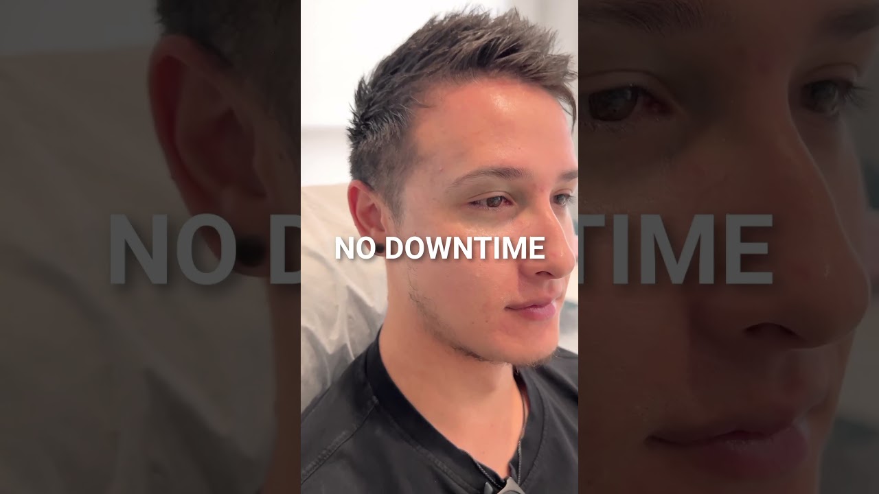 Watch this Birthmark DISAPPEAR #skincondition #lasertreatment #birthmark