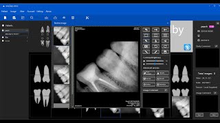How to use XlinearVision Sensor screenshot 3