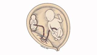 What is twin-to-twin transfusion syndrome (TTTS)?