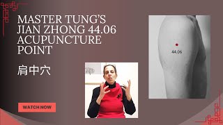 Download Lagu Master Tung's Jian Zhong 44.06 Acupuncture Point MP3