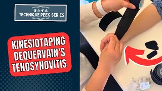 Kinesiotaping Technique for Treatment of DeQuervain's Tenosynovitis  |  Technique Peek Series