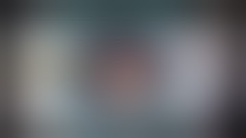 CataractCoach™ 2534: fixing severe zonular loss