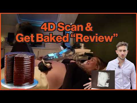 Is a 4D scan worth it Ft Leeds most viral bakery GetBaked