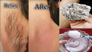 Stop Shaving, Remove Unwanted Hair Permanently|| No Shave No Wex Painless Hair Remover