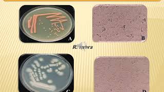 Mutation Effect of Chemical Mutagen Ethymthane sulfonate (EMS) on Some Local Yeasts